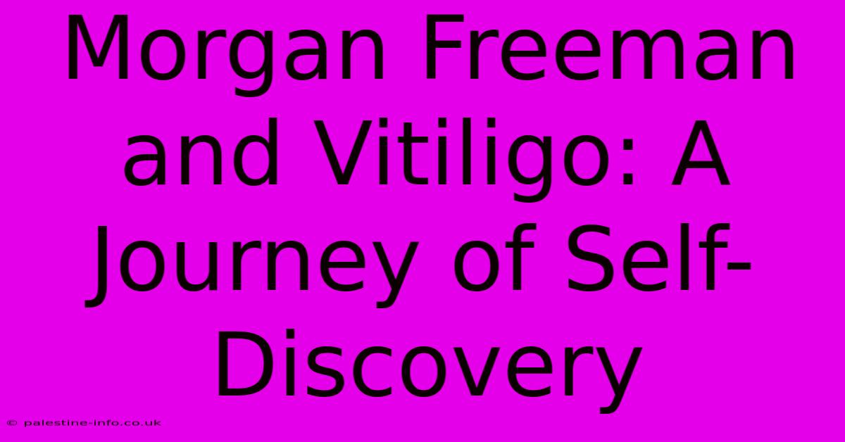 Morgan Freeman And Vitiligo: A Journey Of Self-Discovery