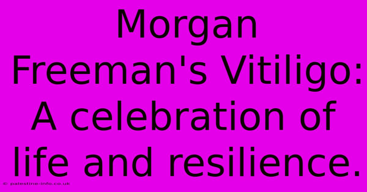 Morgan Freeman's Vitiligo:  A Celebration Of Life And Resilience.