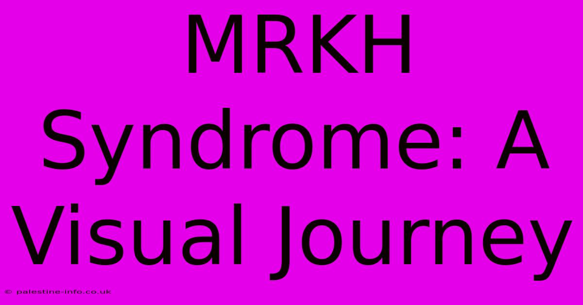 MRKH Syndrome: A Visual Journey