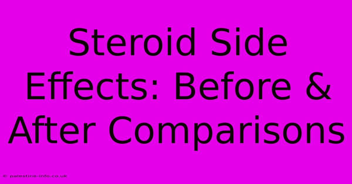 Steroid Side Effects: Before & After Comparisons