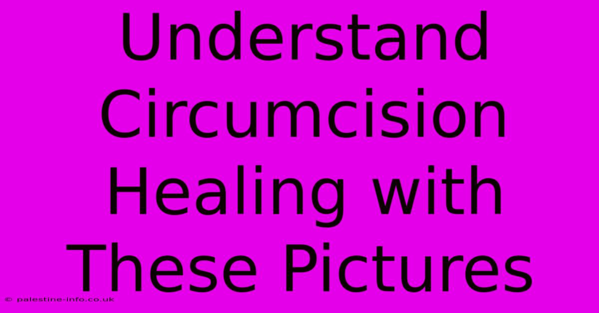 Understand Circumcision Healing With These Pictures