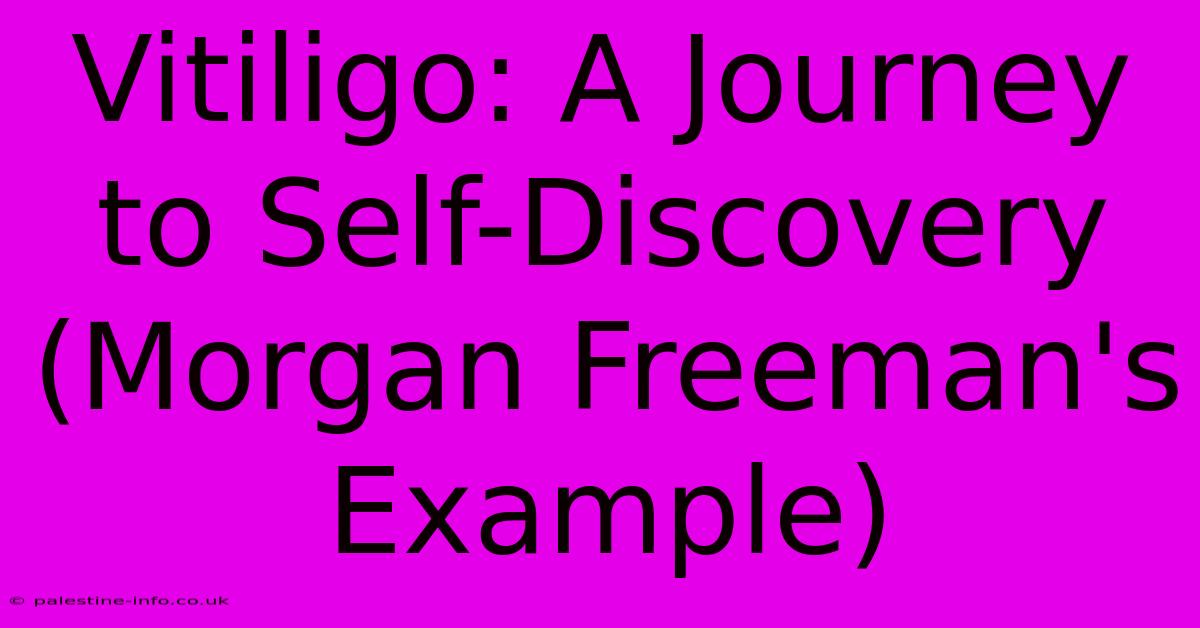 Vitiligo: A Journey To Self-Discovery (Morgan Freeman's Example)